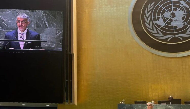 بمبادرة من المملكة العربية السعودية الأمم المتحدة تعتمد يوم 24 نوفمبر من كل عام يوماً عالمياً للتوائم الملتصقة